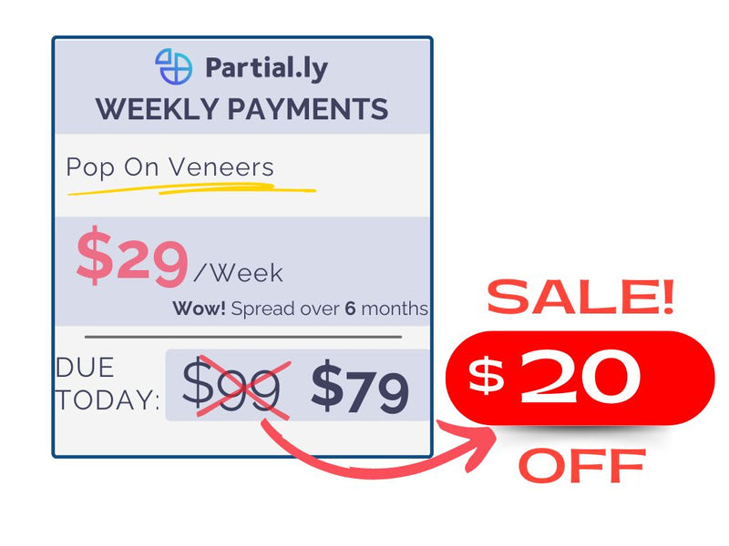 Weekly Payment Plan - Pop On Veneers with At Home Impression Kit - $20 Off