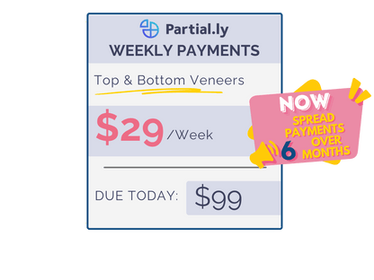 Weekly Payment Plan - Pop On Veneers