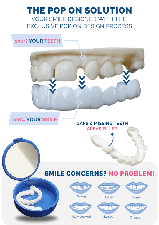 Best decision I made? Choosing Pop On Veneers! – Pop on Veneers